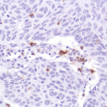 Immunohistochemistry (Formalin/PFA-fixed paraffin-embedded sections) - Anti-CD103 antibody [SP301] - BSA and Azide free (AB245746)