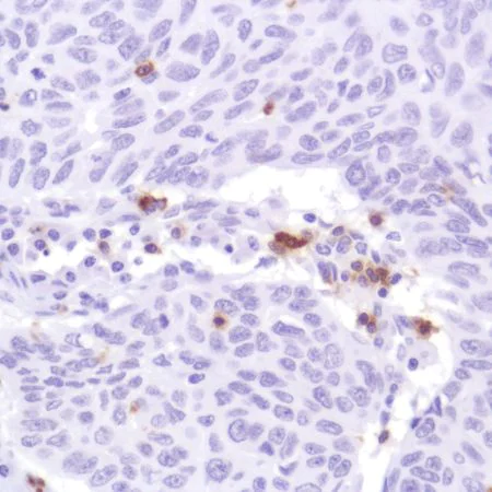 Immunohistochemistry (Formalin/PFA-fixed paraffin-embedded sections) - Anti-CD103 antibody [SP301] - BSA and Azide free (AB245746)