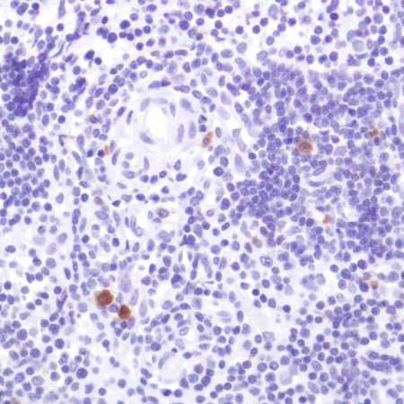 Immunohistochemistry (Formalin/PFA-fixed paraffin-embedded sections) - Anti-CD103 antibody [SP301] - BSA and Azide free (AB245746)