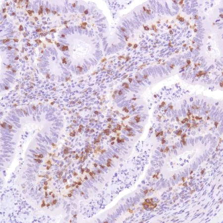 Immunohistochemistry (Formalin/PFA-fixed paraffin-embedded sections) - Anti-CD103 antibody [SP301] - BSA and Azide free (AB245746)