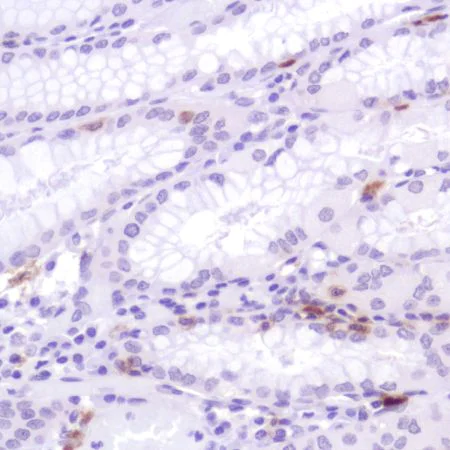 Immunohistochemistry (Formalin/PFA-fixed paraffin-embedded sections) - Anti-CD103 antibody [SP301] - BSA and Azide free (AB245746)