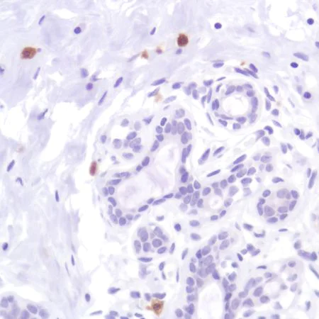 Immunohistochemistry (Formalin/PFA-fixed paraffin-embedded sections) - Anti-CD103 antibody [SP301] - BSA and Azide free (AB245746)