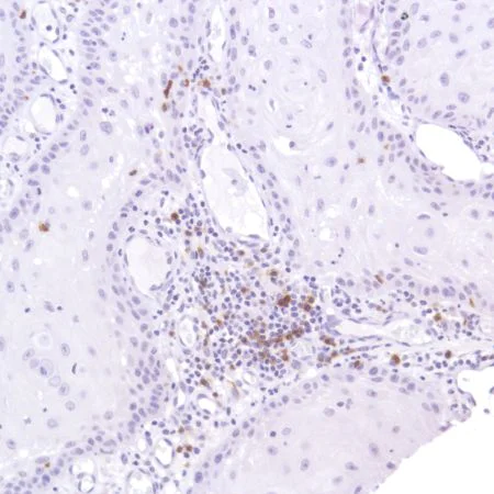 Immunohistochemistry (Formalin/PFA-fixed paraffin-embedded sections) - Anti-CD103 antibody [SP301] - BSA and Azide free (AB245746)