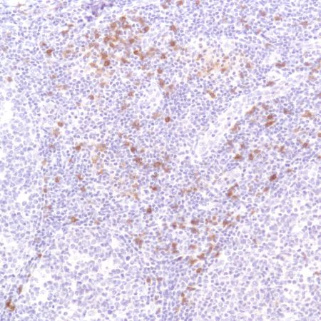 Immunohistochemistry (Formalin/PFA-fixed paraffin-embedded sections) - Anti-CD103 antibody [SP301] - BSA and Azide free (AB245746)