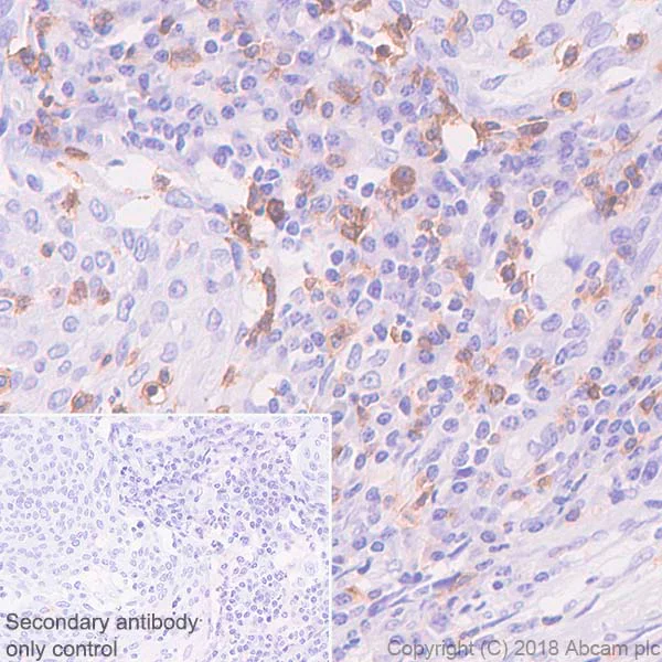 Immunohistochemistry (Formalin/PFA-fixed paraffin-embedded sections) - Anti-CD103 antibody [SP301] - BSA and Azide free (AB245746)
