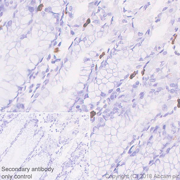 Immunohistochemistry (Formalin/PFA-fixed paraffin-embedded sections) - Anti-CD103 antibody [SP301] - BSA and Azide free (AB245746)