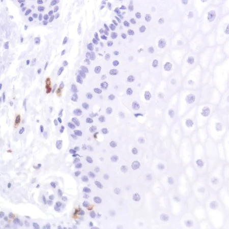 Immunohistochemistry (Formalin/PFA-fixed paraffin-embedded sections) - Anti-CD103 antibody [SP301] - BSA and Azide free (AB245746)