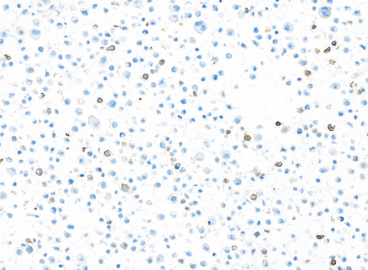Immunocytochemistry - Anti-CD103/ITGAE antibody [BLR171J] - BSA free (AB314101), expandable thumbnail
