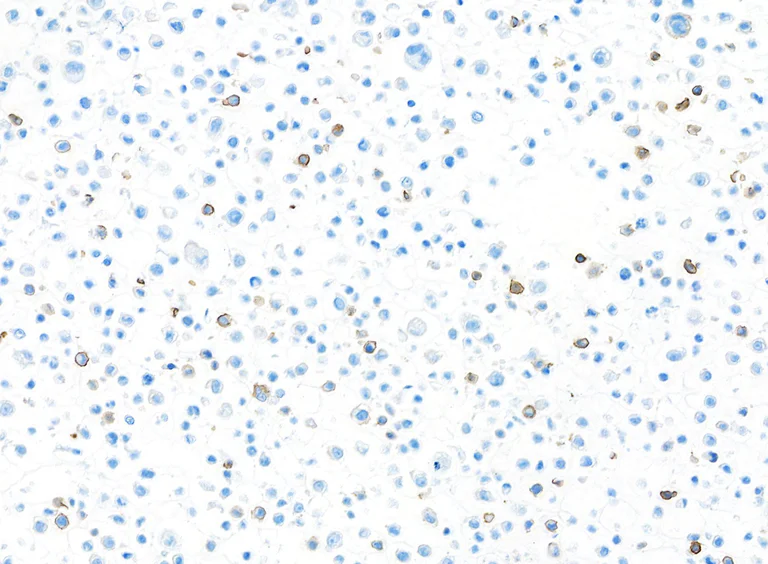 Immunocytochemistry - Anti-CD103/ITGAE antibody [BLR171J] - BSA free (AB314101)