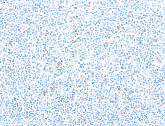Immunohistochemistry (Formalin/PFA-fixed paraffin-embedded sections) - Anti-CD103/ITGAE antibody [BLR171J] - BSA free (AB314101), expandable thumbnail