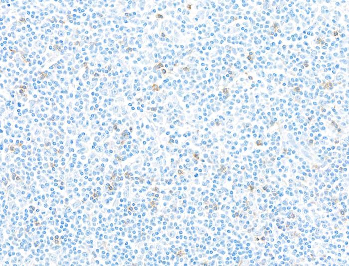 Immunohistochemistry (Formalin/PFA-fixed paraffin-embedded sections) - Anti-CD103/ITGAE antibody [BLR171J] - BSA free (AB314101)