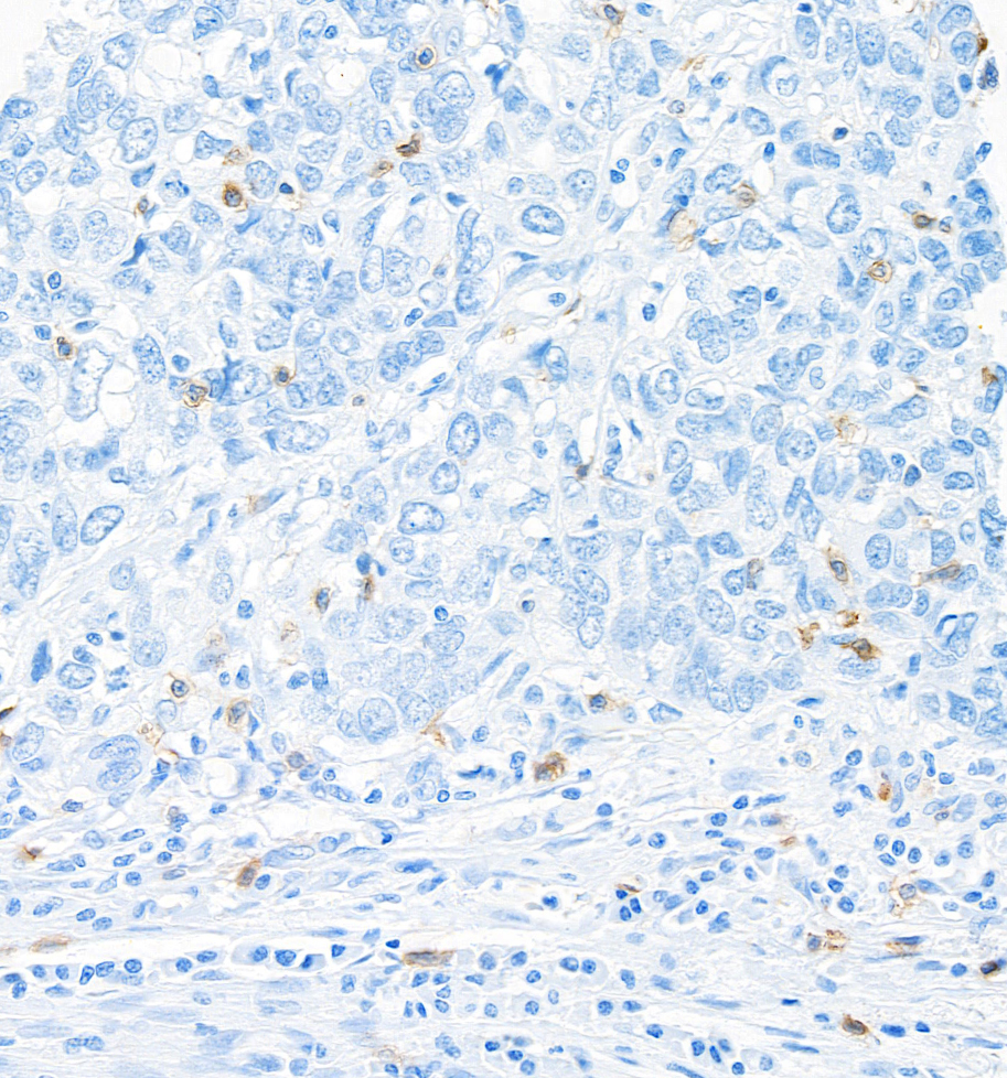 Immunohistochemistry (Formalin/PFA-fixed paraffin-embedded sections) - Anti-CD103/ITGAE antibody [BLR171J] - BSA free (AB314101), expandable thumbnail
