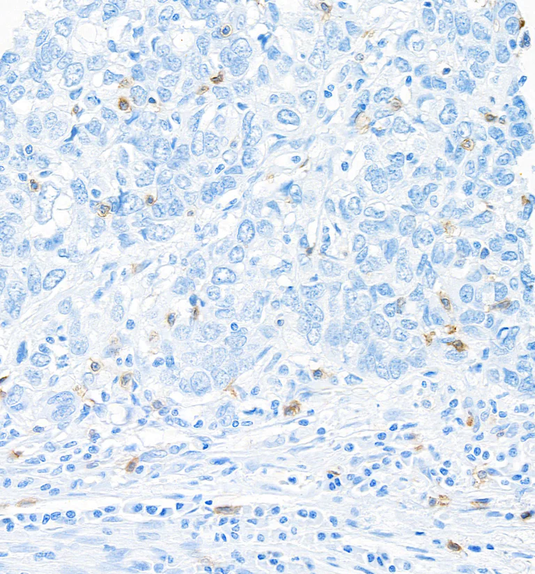 Immunohistochemistry (Formalin/PFA-fixed paraffin-embedded sections) - Anti-CD103/ITGAE antibody [BLR171J] - BSA free (AB314101)