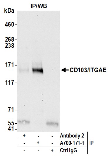 Immunoprecipitation - Anti-CD103/ITGAE antibody [BLR171J] - BSA free (AB314101), expandable thumbnail