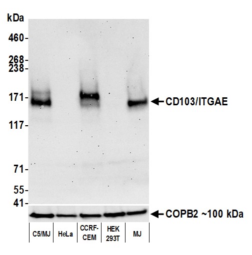 Western blot - Anti-CD103/ITGAE antibody [BLR171J] - BSA free (AB314101), expandable thumbnail