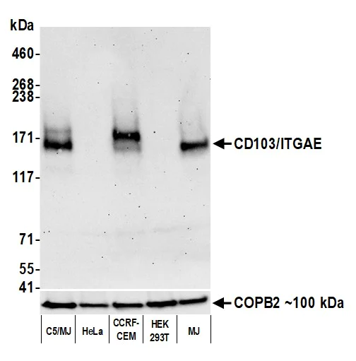 Western blot - Anti-CD103/ITGAE antibody [BLR171J] - BSA free (AB314101)
