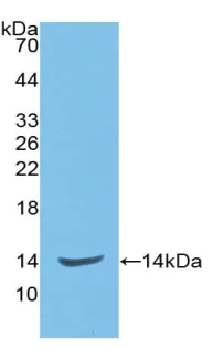 Western blot - Anti-CD105 antibody [17#] (AB239734)