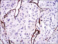 Immunohistochemistry (Formalin/PFA-fixed paraffin-embedded sections) - Anti-CD105 antibody [3A9] (AB114052)