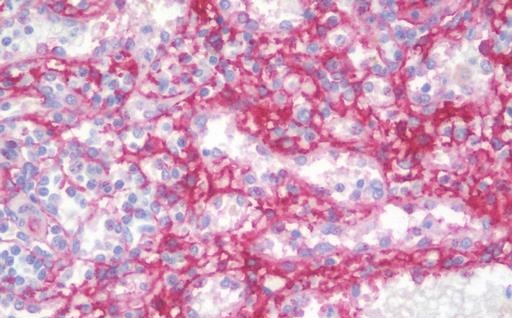 Immunohistochemistry (Formalin/PFA-fixed paraffin-embedded sections) - Anti-CD105 antibody [8A1] (AB230925), expandable thumbnail