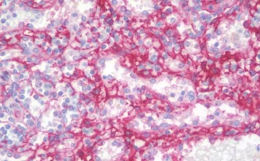 Immunohistochemistry (Formalin/PFA-fixed paraffin-embedded sections) - Anti-CD105 antibody [8A1] (AB230925)
