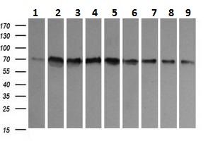 Western blot - Anti-CD105 antibody [8A1] (AB230925), expandable thumbnail