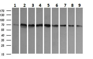Western blot - Anti-CD105 antibody [8A1] (AB230925)