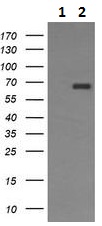Western blot - Anti-CD105 antibody [8A1] (AB230925), expandable thumbnail