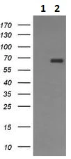 Western blot - Anti-CD105 antibody [8A1] (AB230925)