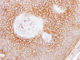 Immunohistochemistry (Formalin/PFA-fixed paraffin-embedded sections) - Anti-CD105 antibody (AB137389)