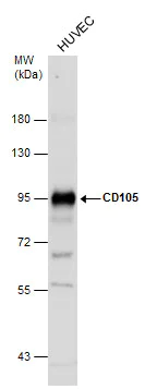 Western blot - Anti-CD105 antibody (AB137389)