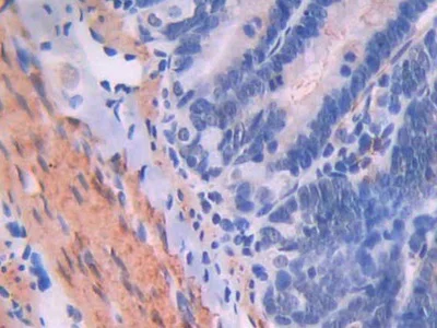 Immunohistochemistry (Formalin/PFA-fixed paraffin-embedded sections) - Anti-CD105 antibody (AB231673)