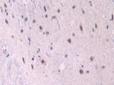 Immunohistochemistry (Formalin/PFA-fixed paraffin-embedded sections) - Anti-CD105 antibody (AB231673)