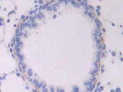 Immunohistochemistry (Formalin/PFA-fixed paraffin-embedded sections) - Anti-CD105 antibody (AB231673)