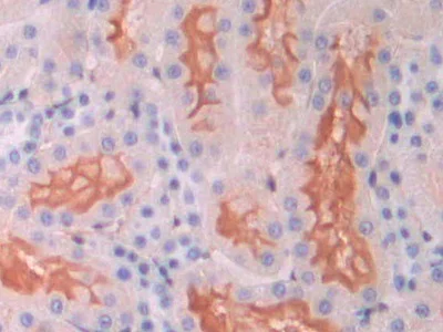 Immunohistochemistry (Formalin/PFA-fixed paraffin-embedded sections) - Anti-CD105 antibody (AB231673)
