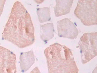 Immunohistochemistry (Formalin/PFA-fixed paraffin-embedded sections) - Anti-CD105 antibody (AB231673)