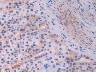 Immunohistochemistry (Formalin/PFA-fixed paraffin-embedded sections) - Anti-CD105 antibody (AB231673)