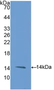 Western blot - Anti-CD105 antibody (AB231673)