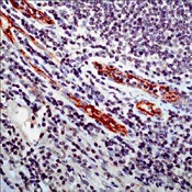 Immunohistochemistry (Formalin/PFA-fixed paraffin-embedded sections) - Anti-CD105 antibody (AB74462)