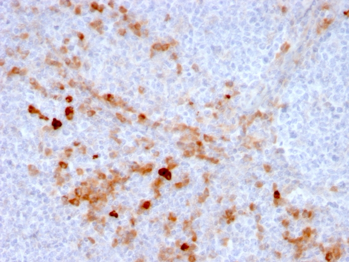Immunohistochemistry (Formalin/PFA-fixed paraffin-embedded sections) - Anti-CD105 antibody [ENG/3269] (AB268052)