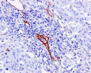 Immunohistochemistry (Formalin/PFA-fixed paraffin-embedded sections) - Anti-CD105 antibody [EPR10145-10] (ab170943), expandable thumbnail
