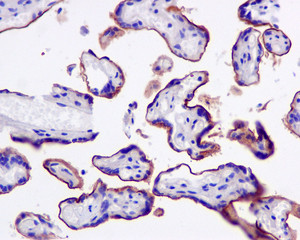 Immunohistochemistry (Formalin/PFA-fixed paraffin-embedded sections) - Anti-CD105 antibody [EPR10145-10] (ab170943), expandable thumbnail