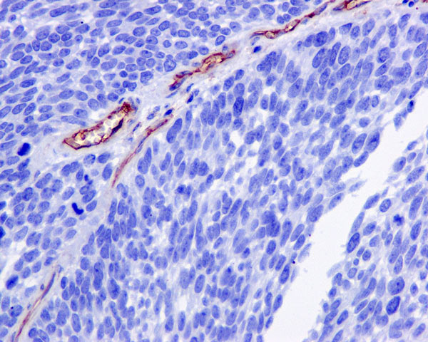 Immunohistochemistry (Formalin/PFA-fixed paraffin-embedded sections) - Anti-CD105 antibody [EPR10145-10] (AB170943), expandable thumbnail