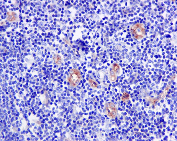 Immunohistochemistry (Formalin/PFA-fixed paraffin-embedded sections) - Anti-CD105 antibody [EPR10145-10] (AB170943), expandable thumbnail