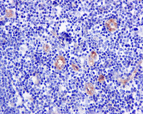 Immunohistochemistry (Formalin/PFA-fixed paraffin-embedded sections) - Anti-CD105 antibody [EPR10145-10] (AB170943)