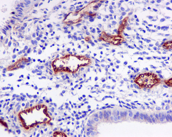 Immunohistochemistry (Formalin/PFA-fixed paraffin-embedded sections) - Anti-CD105 antibody [EPR10145-10] (ab170943), expandable thumbnail