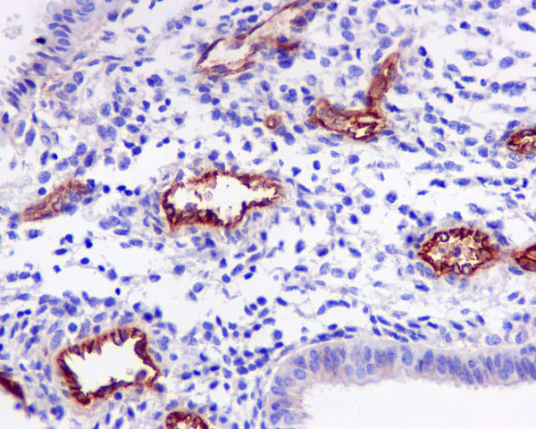 Immunohistochemistry (Formalin/PFA-fixed paraffin-embedded sections) - Anti-CD105 antibody [EPR10145-10] (AB170943)