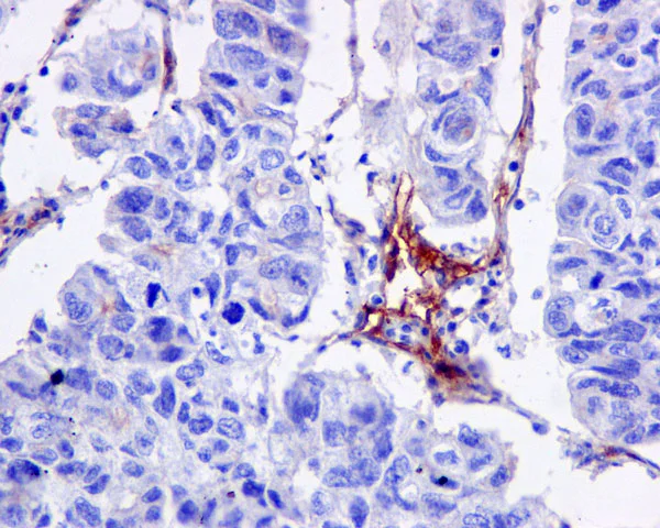 Immunohistochemistry (Formalin/PFA-fixed paraffin-embedded sections) - Anti-CD105 antibody [EPR10145-10] (AB170943)