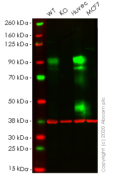 Western blot - Anti-CD105 antibody [EPR10145-10] (AB170943), expandable thumbnail