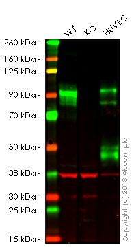 Western blot - Anti-CD105 antibody [EPR10145-10] (AB170943), expandable thumbnail