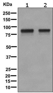 Western blot - Anti-CD105 antibody [EPR10145-10] (ab170943), expandable thumbnail